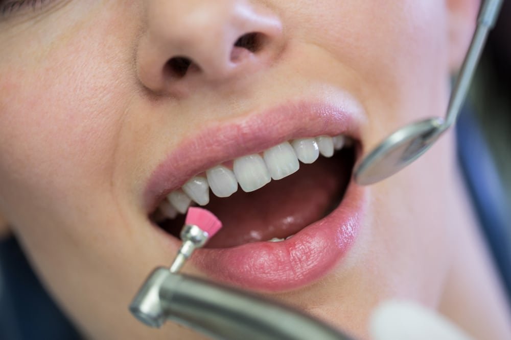 Trusted Aesthetic Dentistry in Borivali | All Smilez Dental Care